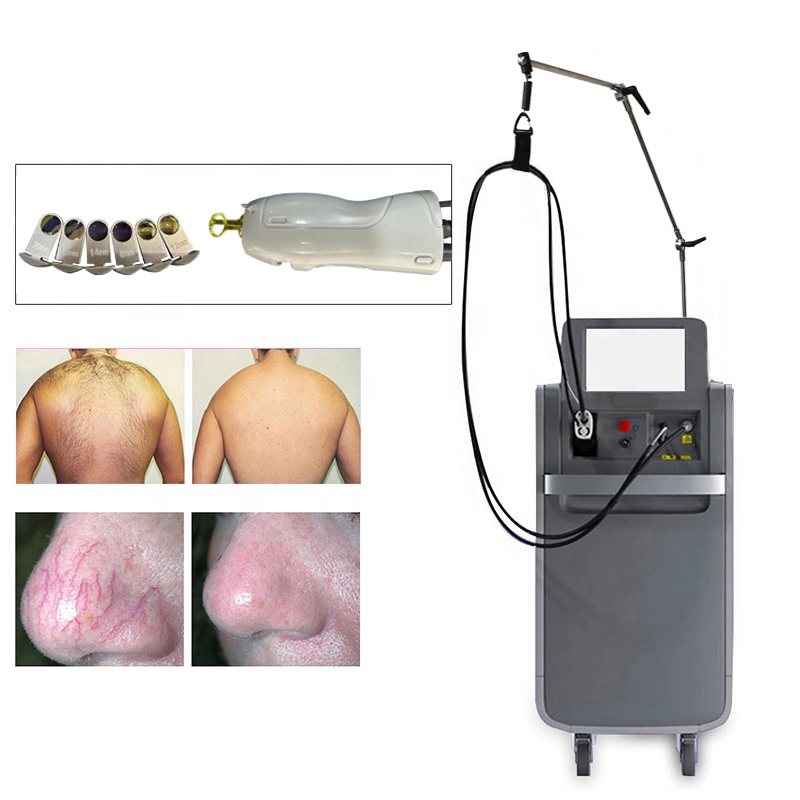 30% Disocunt New Hair Removal Machine Long Pulsed ND YAG Laser 1064nm Alexandrite 755nm Laser